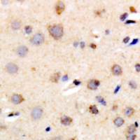 19 - Anti-R Cadherin Antibody AP61467