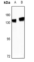 1 - Anti-R Cadherin Antibody AP61467