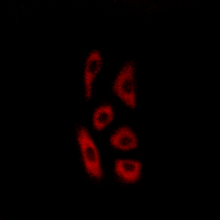 3 - Anti-ACOT12 Antibody AP61468