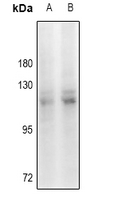 1 - Anti-KANK2 Antibody AP61469