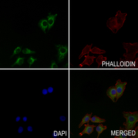 3 - Anti-PXMP4 Antibody AP61470