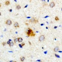 19 - Anti-PXMP4 Antibody AP61470