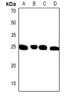 1 - Anti-PXMP4 Antibody AP61470