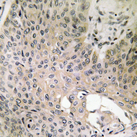 19 - Anti-SHCC Antibody AP61472