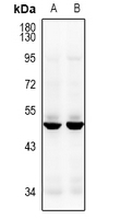 1 - Anti-CACNG8 Antibody AP61473