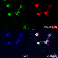 3 - Anti-Semaphorin 6D Antibody AP61474