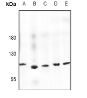 1 - Anti-Semaphorin 6D Antibody AP61474