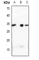 1 - Anti-Complement C1S LC Antibody AP61476