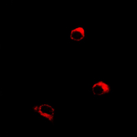 3 - Anti-Orexin Receptor 1 Antibody AP61479