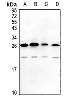 1 - Anti-MAGEA5 Antibody AP61480