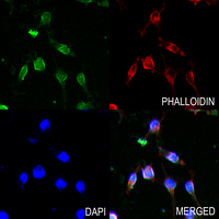 3 - Anti-EAAT2 Antibody AP61485