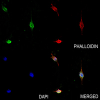 3 - Anti-Fetuin A Antibody AP61487