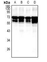 1 - Anti-Fetuin A Antibody AP61487
