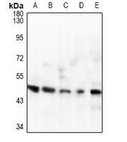 1 - Anti-IL-1R2 Antibody AP61489