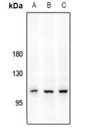 1 - Anti-CD167a (Phospho-Y792) Antibody AP61490