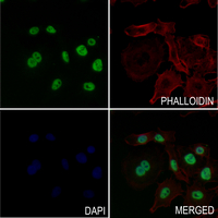 3 - Anti-Histone H2A (Acetyl-K9) Antibody AP61491