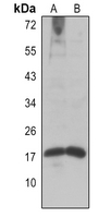 1 - Anti-Histone H2A (Acetyl-K9) Antibody AP61491