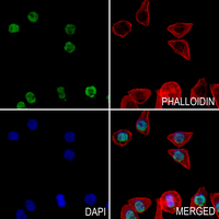 3 - Anti-Histone H2A (Acetyl-K5) Antibody AP61492