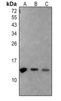 1 - Anti-Histone H2A (Acetyl-K5) Antibody AP61492