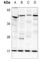 1 - Anti-Histone H2B (Acetyl-K125) Antibody AP61493