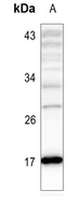 1 - Anti-Histone H3 (Acetyl-K4) Antibody AP61494
