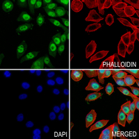 3 - Anti-Histone H2B (Butyryl-K12) Antibody AP61495