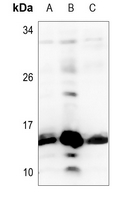 1 - Anti-Histone H2B (Butyryl-K12) Antibody AP61495