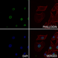 3 - Anti-Histone H3 (Butyryl-K9) Antibody AP61496