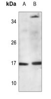 1 - Anti-Histone H3 (Butyryl-K9) Antibody AP61496