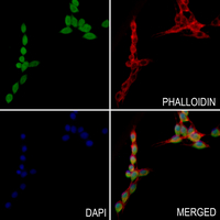 3 - Anti-Histone H3 (MonoMethyl-K27) Antibody AP61497
