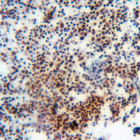 19 - Anti-Histone H3 (MonoMethyl-K27) Antibody AP61497