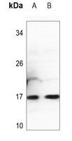 1 - Anti-Histone H3 (MonoMethyl-K27) Antibody AP61497