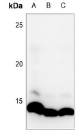 1 - Anti-Histone H4 (MonoMethyl-K20) Antibody AP61498
