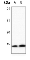 1 - Anti-Histone H4 (DiMethyl-K20) Antibody AP61499