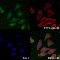 3 - Anti-Histone H4 (TriMethyl-K20) Antibody AP61500