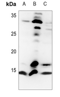 1 - Anti-Histone H4 (TriMethyl-K20) Antibody AP61500