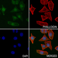 3 - Anti-Histone H3 (MonoMethyl-K56) Antibody AP61501
