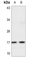 1 - Anti-Histone H3 (MonoMethyl-K56) Antibody AP61501