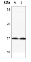 1 - Anti-Histone H3 (MonoMethyl-K122) Antibody AP61502