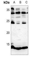 1 - Anti-Histone H4 (MonoMethyl-R3) Antibody AP61503