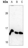 1 - Anti-Histone H4 (MonoMethyl-K12) Antibody AP61504