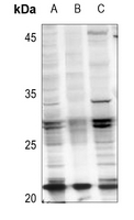 1 - Anti-RAB21 (Acetyl-K109) Antibody AP61505