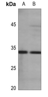 1 - Anti-Aquaporin 3 Antibody AP61506