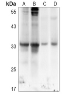 0 - Anti-Aquaporin 3 Antibody AP61506