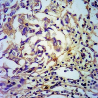 19 - Anti-PDGFB Antibody AP61507