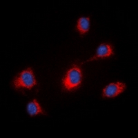 3 - Anti-MID1 Antibody AP61508