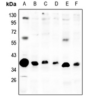 1 - Anti-mPR alpha Antibody AP61509