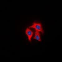 3 - Anti-FAP alpha Antibody AP61510
