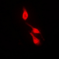 3 - Anti-p38 (Phospho-Y182) Antibody AP61511