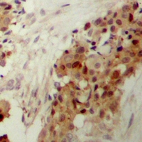 19 - Anti-p38 (Phospho-Y182) Antibody AP61511
